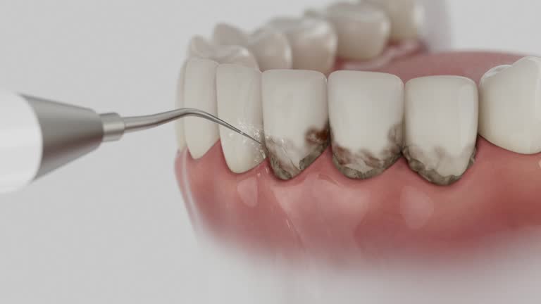 Trusted Teeth Whitening service in Wamego, KS - Dentist Open Now